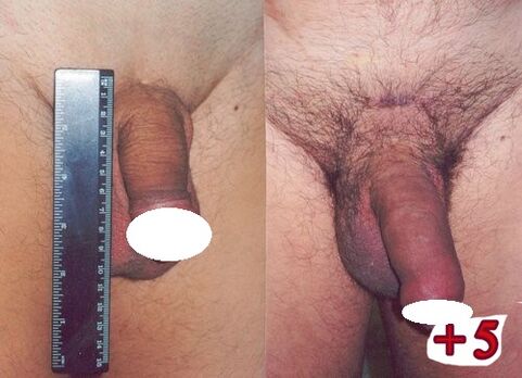 Αποτελέσματα πριν και μετά την αύξηση του μέλους